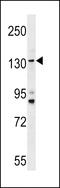 Transmembrane Channel Like 5 antibody, 59-628, ProSci, Western Blot image 