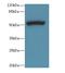 Porcupine O-Acyltransferase antibody, LS-C380102, Lifespan Biosciences, Western Blot image 