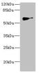 Solute Carrier Family 22 Member 8 antibody, LS-C676504, Lifespan Biosciences, Western Blot image 