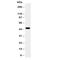 Mitogen-Activated Protein Kinase 8 antibody, R30992, NSJ Bioreagents, Western Blot image 