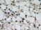 Sequestosome 1 antibody, 18420-1-AP, Proteintech Group, Immunohistochemistry frozen image 