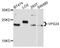 Charged Multivesicular Body Protein 3 antibody, abx126787, Abbexa, Western Blot image 