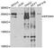 Eukaryotic translation initiation factor 2-alpha kinase 4 antibody, A7155, ABclonal Technology, Western Blot image 