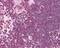 Arachidonate 5-Lipoxygenase antibody, 48-722, ProSci, Immunohistochemistry paraffin image 