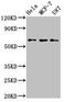 Kyphoscoliosis Peptidase antibody, LS-C674688, Lifespan Biosciences, Western Blot image 