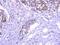 Exocyst Complex Component 1 antibody, PA5-31529, Invitrogen Antibodies, Immunohistochemistry paraffin image 