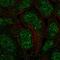 Ankyrin Repeat Domain 22 antibody, PA5-53010, Invitrogen Antibodies, Immunofluorescence image 