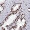 Protocadherin Beta 11 antibody, PA5-60905, Invitrogen Antibodies, Immunohistochemistry frozen image 