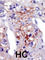 Phosphatidylinositol-4-Phosphate 5-Kinase Type 1 Gamma antibody, abx033837, Abbexa, Western Blot image 