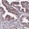 Homeobox A4 antibody, NBP2-32515, Novus Biologicals, Immunohistochemistry paraffin image 