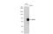 Nuclear Receptor Subfamily 1 Group D Member 1 antibody, GTX113904, GeneTex, Western Blot image 