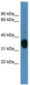 Aldo-Keto Reductase Family 1 Member C1 antibody, TA342867, Origene, Western Blot image 