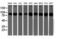 Proteasome 26S Subunit, Non-ATPase 2 antibody, M06642, Boster Biological Technology, Western Blot image 
