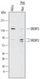 Sterol Regulatory Element Binding Transcription Factor 2 antibody, AF7119, R&D Systems, Western Blot image 