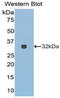 Collagen Type III Alpha 1 Chain antibody, LS-C293430, Lifespan Biosciences, Western Blot image 