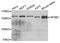Splicing Factor 3b Subunit 2 antibody, MBS129733, MyBioSource, Western Blot image 