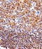 Nuclear Factor Kappa B Subunit 1 antibody, M00283-2, Boster Biological Technology, Immunohistochemistry paraffin image 