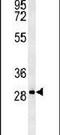 Transmembrane Protein 165 antibody, PA5-25423, Invitrogen Antibodies, Western Blot image 