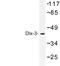 Distal-Less Homeobox 3 antibody, LS-C176704, Lifespan Biosciences, Western Blot image 