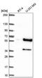 Cyclin B1 antibody, NBP2-56867, Novus Biologicals, Western Blot image 