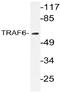 TNF Receptor Associated Factor 6 antibody, AP20777PU-N, Origene, Western Blot image 