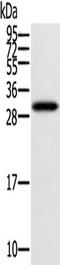 StAR Related Lipid Transfer Domain Containing 5 antibody, TA351760, Origene, Western Blot image 