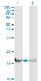 Ribosomal Protein S19 antibody, LS-C198127, Lifespan Biosciences, Western Blot image 