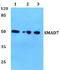 SMAD Family Member 7 antibody, A00784, Boster Biological Technology, Western Blot image 