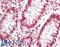 Elongation Factor Tu GTP Binding Domain Containing 2 antibody, LS-B13400, Lifespan Biosciences, Immunohistochemistry paraffin image 