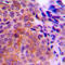 Casein Kinase 1 Gamma 1 antibody, LS-C354182, Lifespan Biosciences, Immunohistochemistry paraffin image 