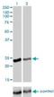 RAB4A, Member RAS Oncogene Family antibody, H00005867-M01, Novus Biologicals, Western Blot image 