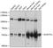 Aldehyde Dehydrogenase 7 Family Member A1 antibody, 23-693, ProSci, Western Blot image 