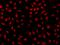 MX Dynamin Like GTPase 2 antibody, 205901-T02, Sino Biological, Immunohistochemistry paraffin image 