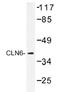 Ceroid-lipofuscinosis neuronal protein 6 antibody, AP01390PU-N, Origene, Western Blot image 