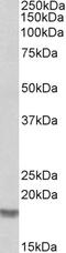 Cofilin 2 antibody, 45-036, ProSci, Western Blot image 