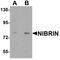 Nibrin antibody, LS-C153699, Lifespan Biosciences, Western Blot image 