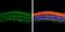 G Protein Subunit Alpha Transducin 2 antibody, GTX134342, GeneTex, Immunohistochemistry paraffin image 