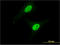 Calpain 3 antibody, LS-C196814, Lifespan Biosciences, Immunofluorescence image 
