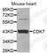Cyclin Dependent Kinase 7 antibody, A1694, ABclonal Technology, Western Blot image 