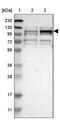 Transmembrane And Tetratricopeptide Repeat Containing 1 antibody, PA5-53480, Invitrogen Antibodies, Western Blot image 