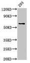 Lysophosphatidylcholine Acyltransferase 2 antibody, CSB-PA013053LA01HU, Cusabio, Western Blot image 