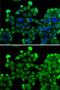 Small Nuclear Ribonucleoprotein D2 Polypeptide antibody, GTX33510, GeneTex, Immunocytochemistry image 