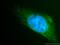 Unknown protein from 2D-PAGE of fibroblasts antibody, 10272-2-AP, Proteintech Group, Immunofluorescence image 