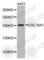 Collagen Type XVIII Alpha 1 Chain antibody, A1722, ABclonal Technology, Western Blot image 