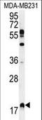 Ras Homolog, MTORC1 Binding antibody, LS-C162588, Lifespan Biosciences, Western Blot image 