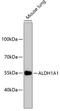 Aldehyde Dehydrogenase 1 Family Member A1 antibody, 13-927, ProSci, Western Blot image 
