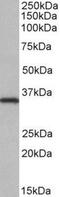 NIMA Related Kinase 7 antibody, NBP1-52115, Novus Biologicals, Western Blot image 