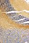 NME/NM23 Nucleoside Diphosphate Kinase 1 antibody, LS-C312974, Lifespan Biosciences, Immunohistochemistry paraffin image 