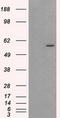 AKT Serine/Threonine Kinase 2 antibody, LS-C114858, Lifespan Biosciences, Western Blot image 