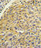 Cytosolic phospholipase A2 antibody, A00854-1, Boster Biological Technology, Immunohistochemistry paraffin image 